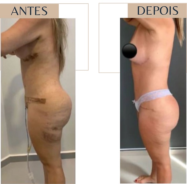Resultado real